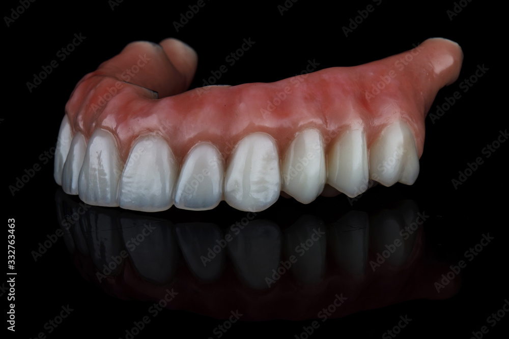 excellent dental prosthesis for the upper jaw on black glass with a beautiful reflection, side view excellent dental prosthesis for the upper jaw on black glass with a beautiful reflection, side view