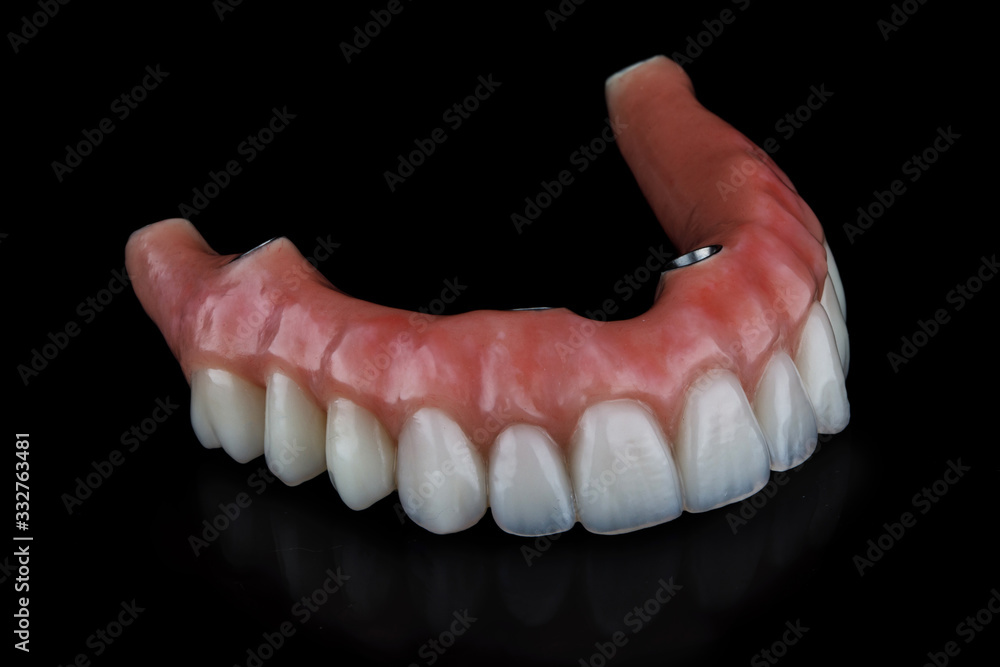 high-quality dental prosthesis for the upper jaw with a pink gum on a black background high-quality dental prosthesis for the upper jaw with a pink gum on a black background