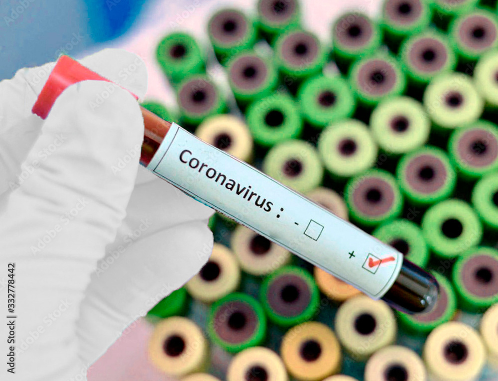 Obraz premium coronavirus in a flask in a hand