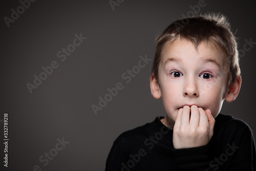 Anxiety/fear in a little boy - education concept hinting behavioral problems in young children (shallow DOF) - anxious/scared expression, biting his fingers