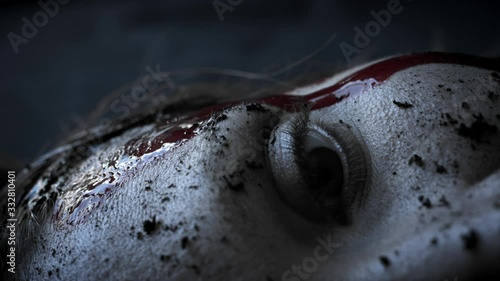 4k Dead Human Body Cadaver Laying Killed in Blood