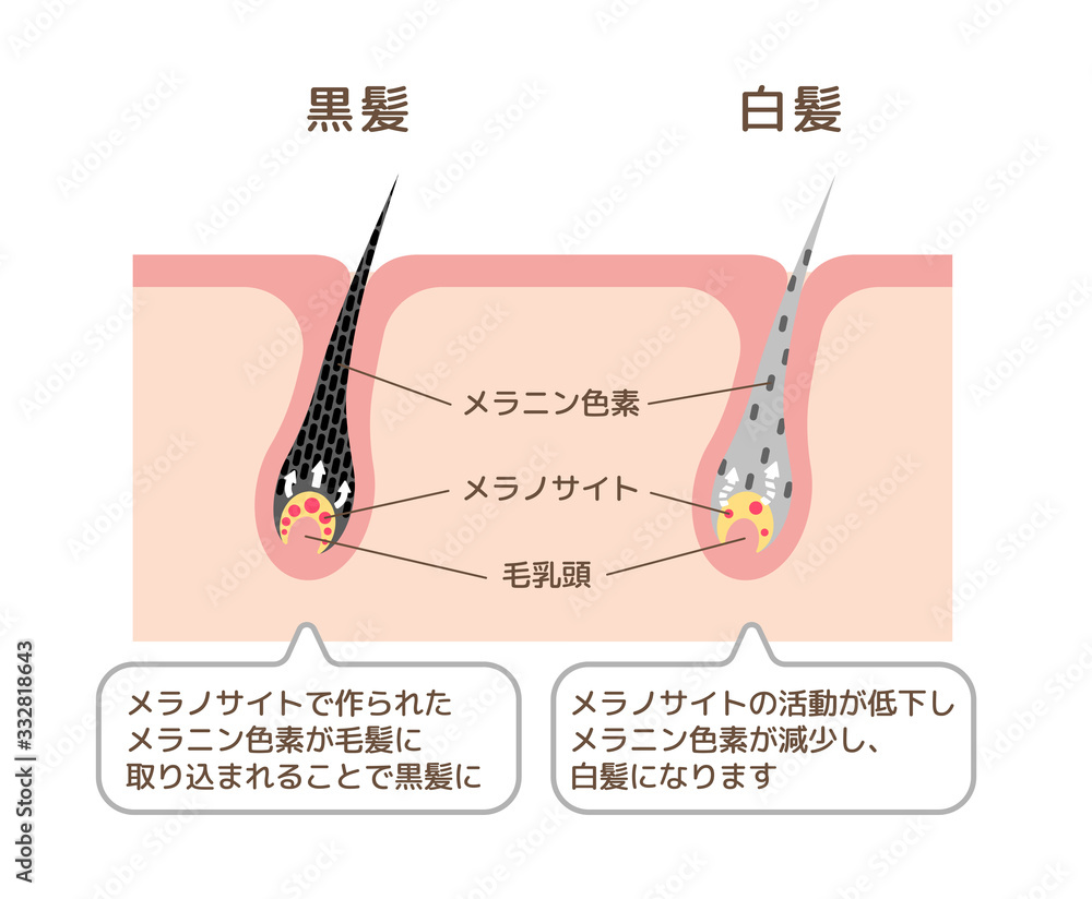 黒髪と白髪 発生の仕組み メカニズム比較 皮膚断面図イラスト Stock Vector Adobe Stock