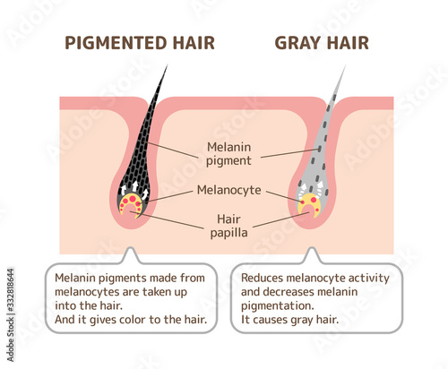 Mechanism of pigmented hair and gray hair / comparison vector illustration