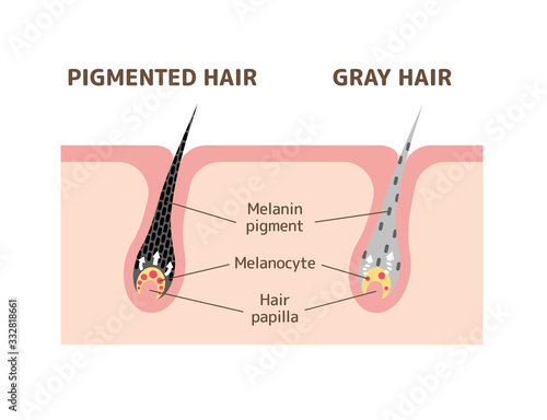 Mechanism of pigmented hair and gray hair / comparison vector illustration