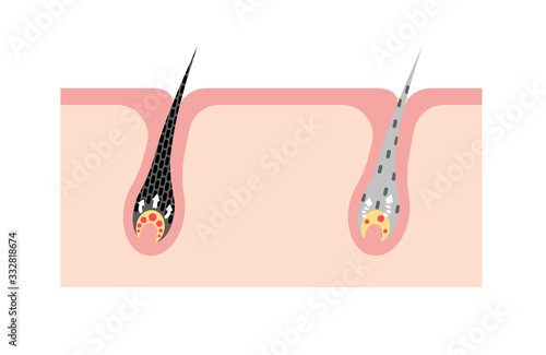 Mechanism of pigmented hair and gray hair / comparison vector illustration / no text