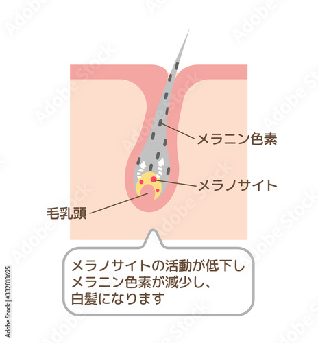 白髪 発生の仕組み・メカニズム 皮膚断面図イラスト