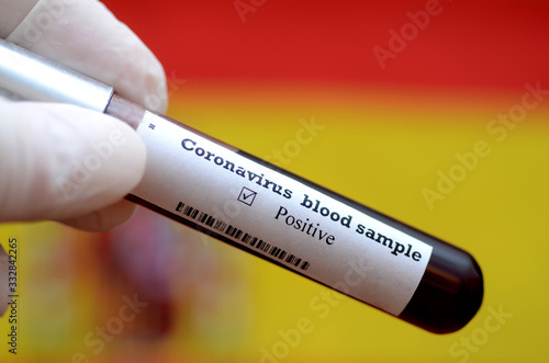 Stock photo of holding tube with Blood Test(novel Coronavirus 2019 disease,COVID-19,nCoV) and flag of Spain. Spain virus outbreak.