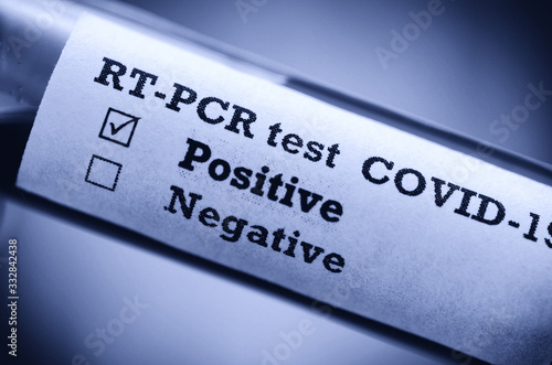 Stock photo of tube with Positive Blood Test(novel Coronavirus 2019 disease,COVID-19,nCoV)