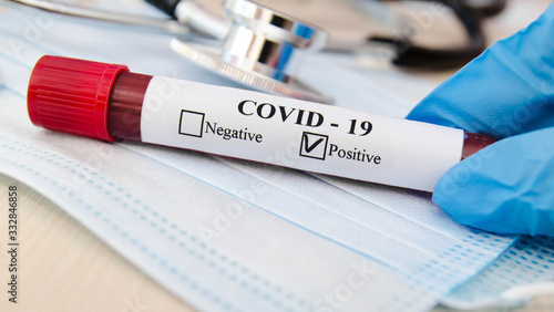 Coronavirus blood test concept. Doctor hand in medical glove holding test tube with coronavirus positive blood