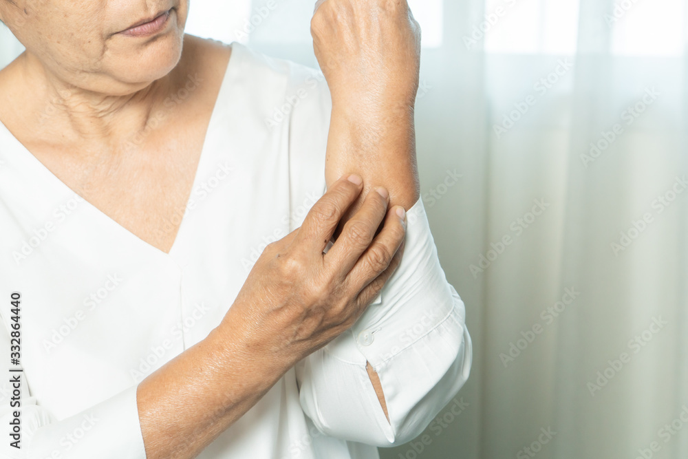 Fototapeta premium senior women scratch hand the itch on eczema arm, healthcare and medicine concept