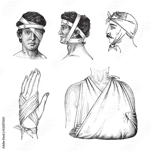 First aid bandage / vintage illustration from Brockhaus Konversations-Lexikon 1908