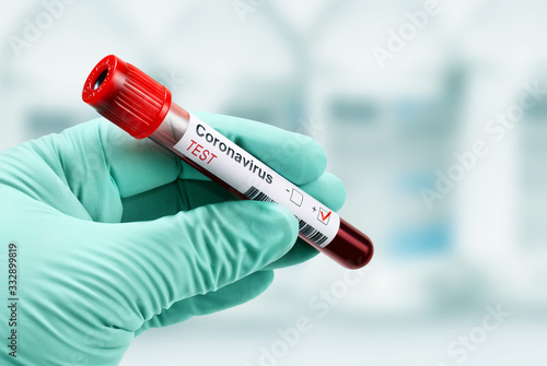 Test for coronavirus positive result