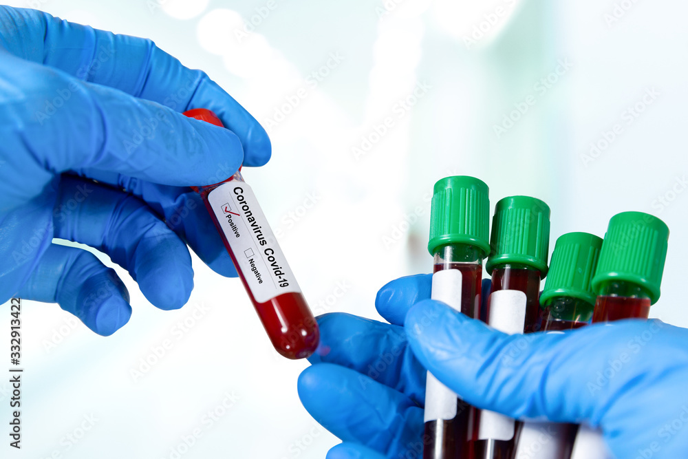Doctor hand holding blood tube test. Doctor hand holding blood tube test.
