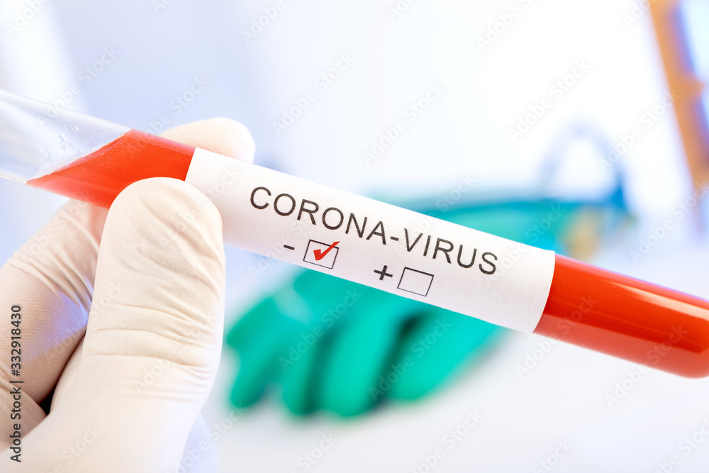 Fototapeta premium CORONA Virus