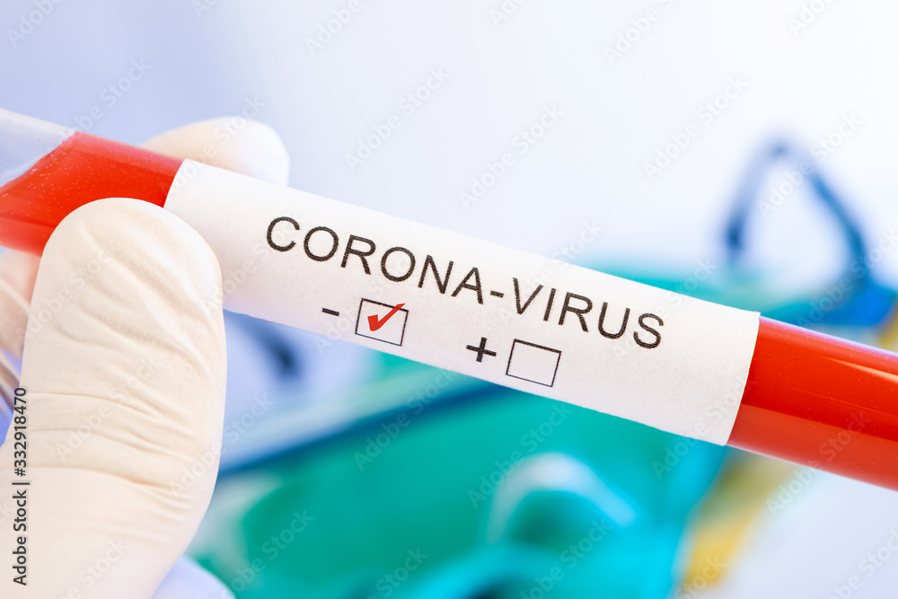 Obraz premium CORONA Virus
