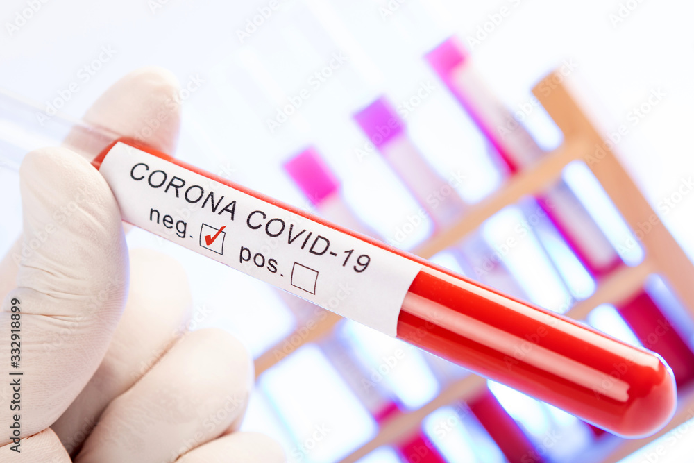 Fototapeta premium CORONA Virus