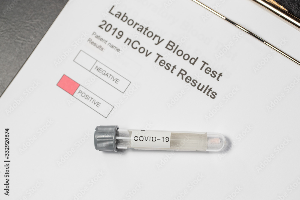 Obraz premium Laboratory results for nCov - 19 positive negative