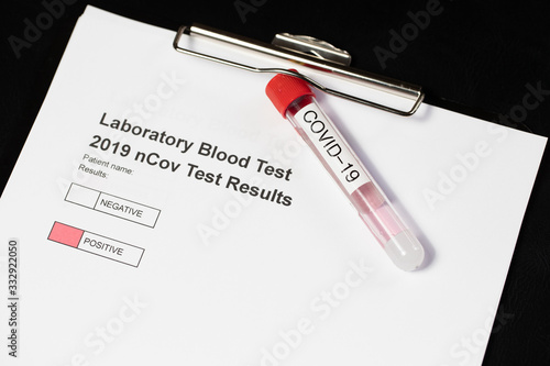 Laboratory results for nCov - 19 positive negative