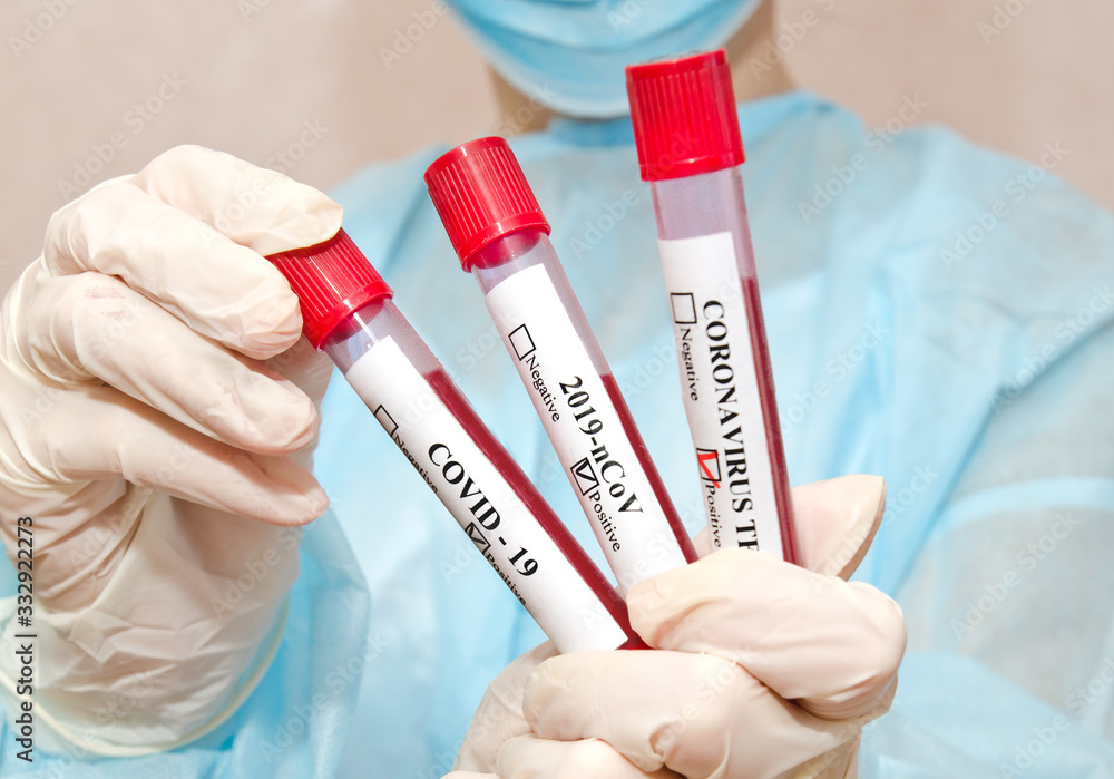 Nurse holding test tube with blood for 2019-nCoV analyzing Nurse holding test tube with blood for 2019-nCoV analyzing