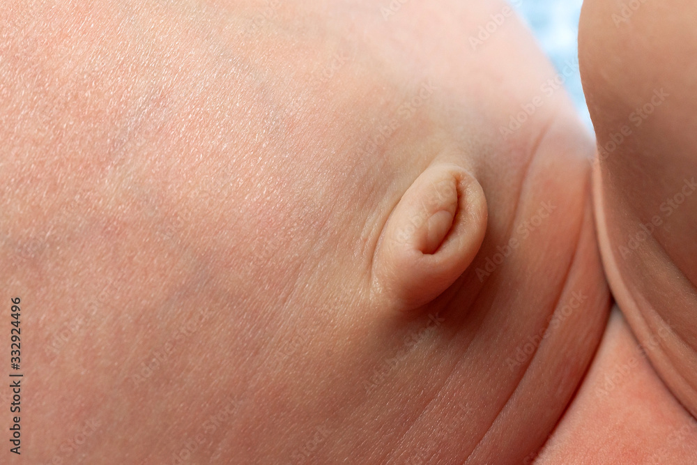 Fototapeta premium navel of newborn baby, closeup image