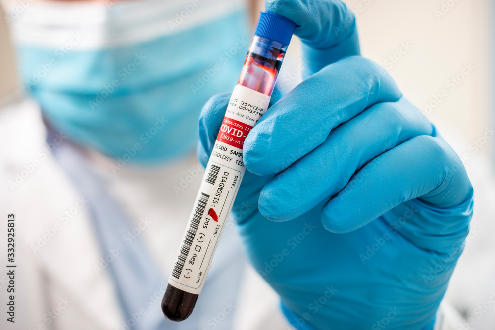 Doctor holding test tube blood sample Doctor holding test tube blood sample