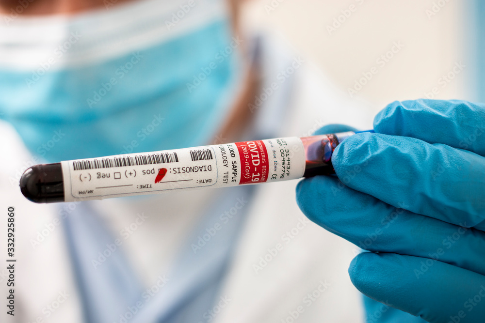 Doctor holding test tube blood sample Doctor holding test tube blood sample