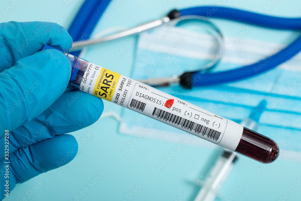 Blood samples with infected virus Blood samples with infected virus