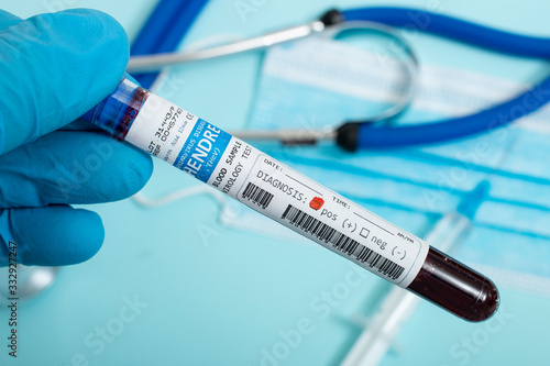 Blood samples with infected virus photo