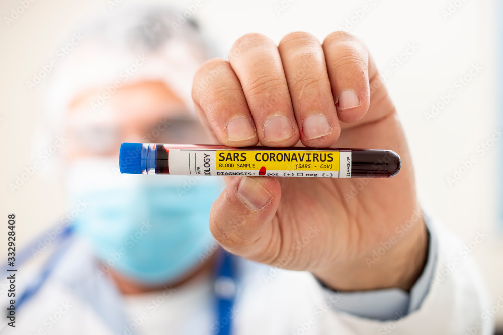 Fototapeta premium Doctor holding test tube blood sample