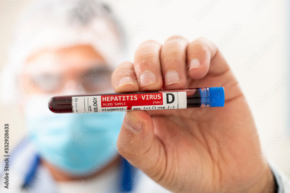 Fototapeta premium Doctor holding test tube blood sample