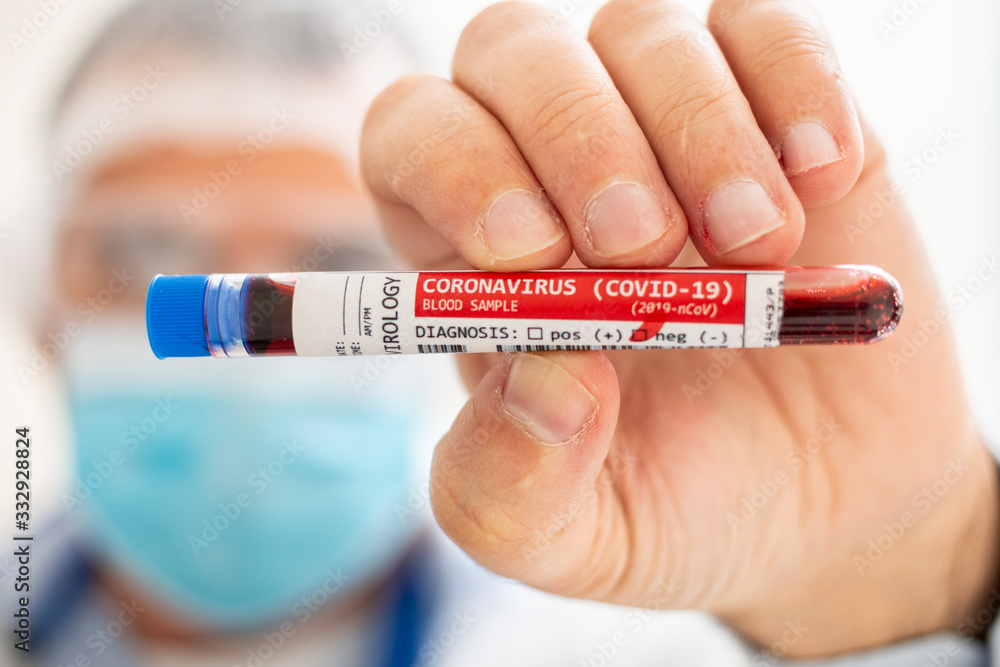 Fototapeta premium Doctor holding test tube blood sample