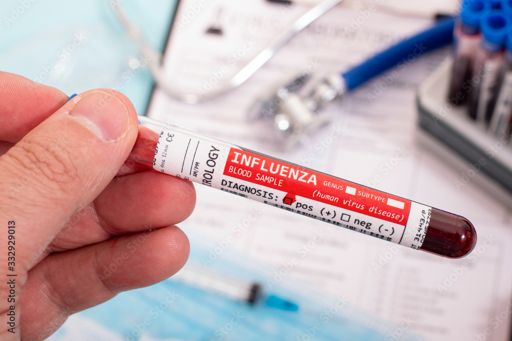 Obraz premium Blood samples with infected virus