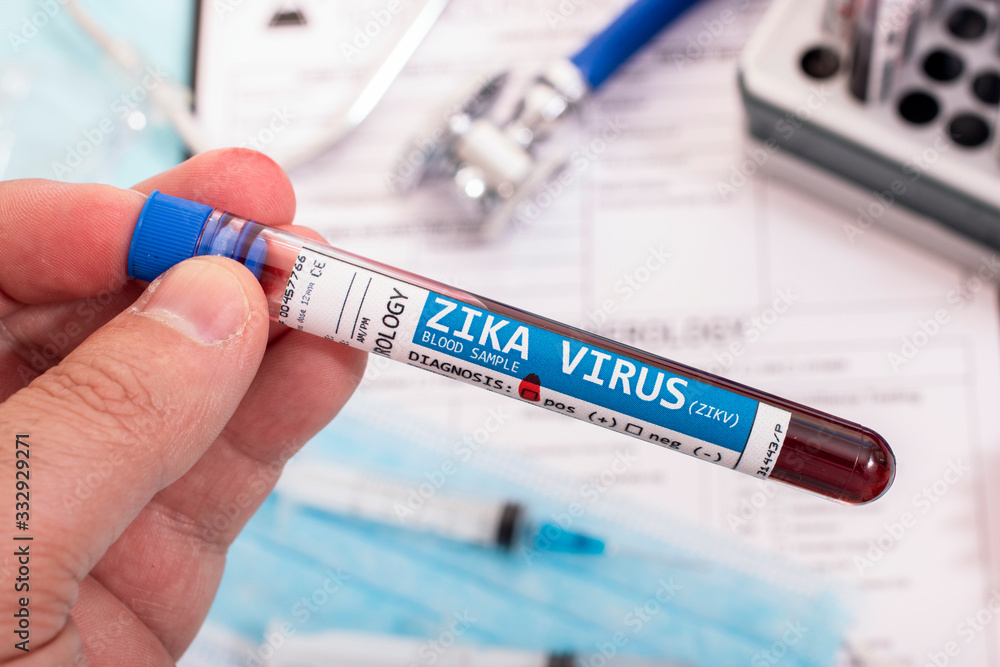 Fototapeta premium Blood samples with infected virus