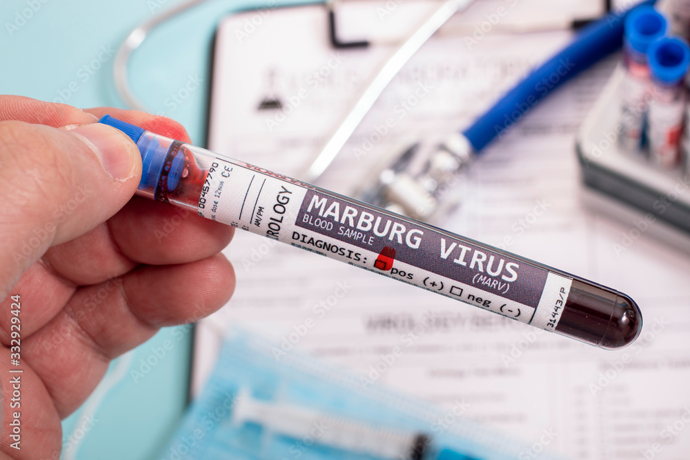 Fototapeta premium Blood samples with infected virus