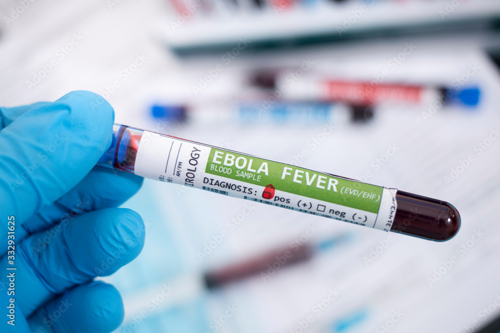 Fototapeta premium Blood samples with infected virus