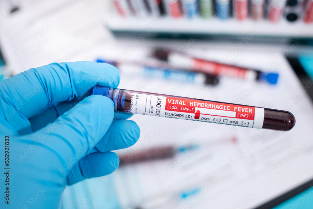 Fototapeta premium Blood samples with infected virus