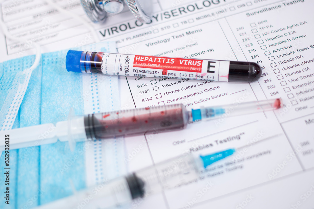Blood samples with infected virus Blood samples with infected virus