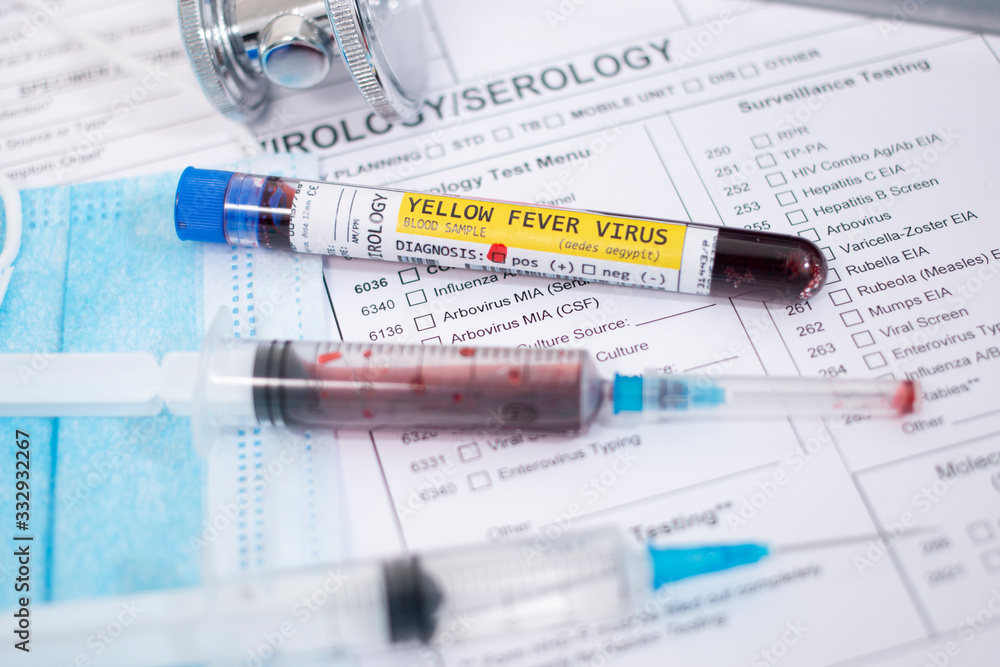 Blood samples with infected virus Blood samples with infected virus