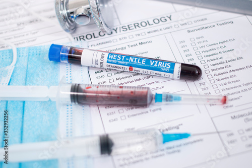 Slika na platnu Blood samples with infected virus