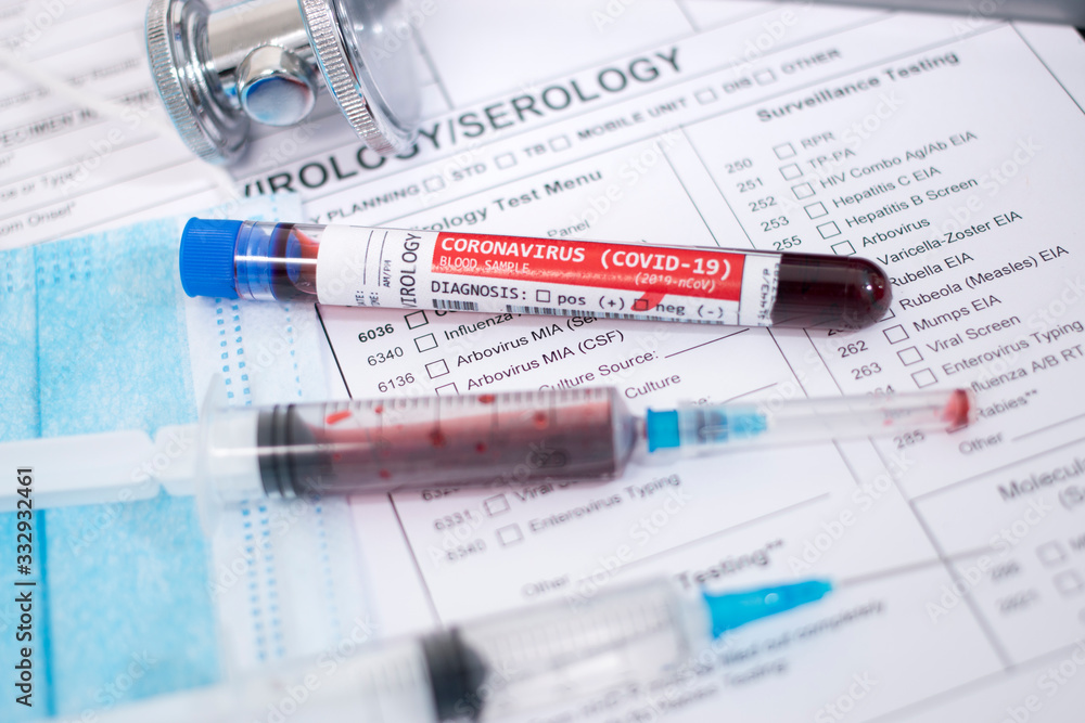 Blood samples with infected virus Blood samples with infected virus