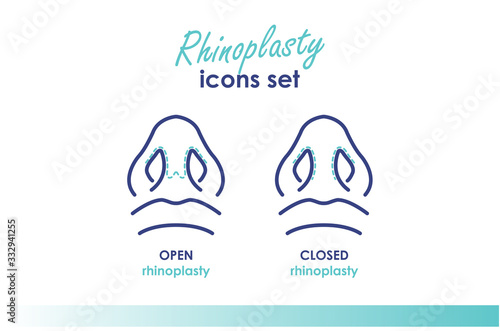 Rhinoplasty. Open and closed rhinoplasty. Plastic surgery nose. Bottom view. Medical and beauty illustration