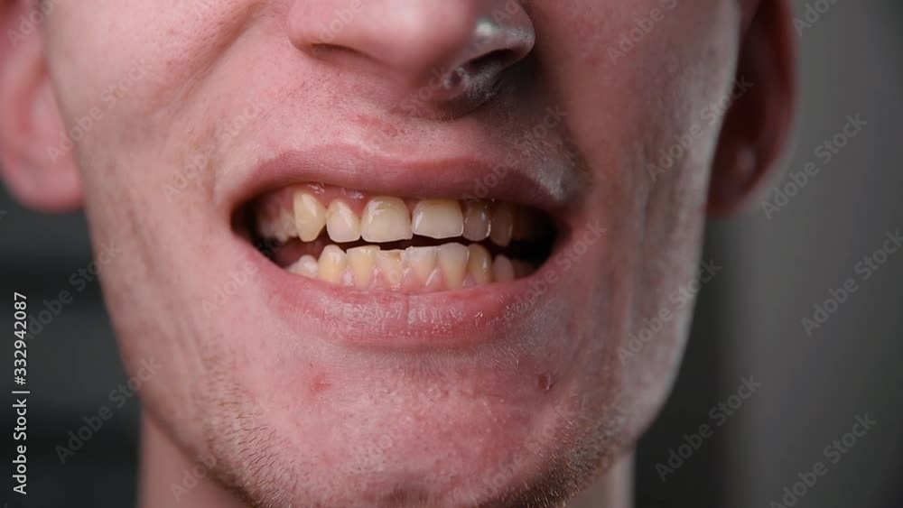 Man shows yellow teeth in bath. The guy is smiling. Front view. Close-up Man shows yellow teeth in bath. The guy is smiling. Front view. Close-up