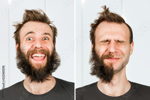 Fotografia happy guy with half beard and without hair loss