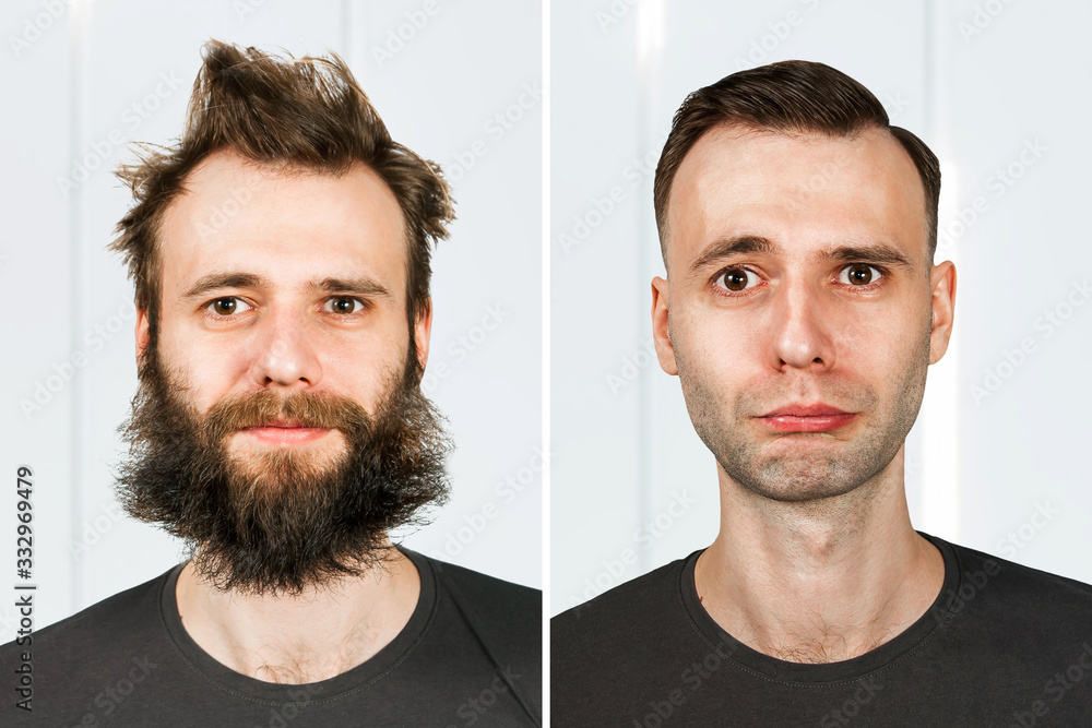 guy with beard and without hair loss. Man before and after shave or transplant. haircut set transformation. guy with beard and without hair loss. Man before and after shave or transplant. haircut set transformation.
