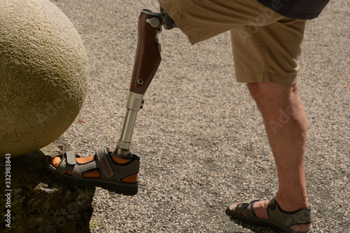 bionic carbon leg prosthesis of a man, left leg prosthesis self-assured man wearing shorts photo