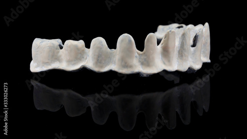 dental titanium beam with apak material on the lower jaw of the patient, shot from the side on a black mirror photo