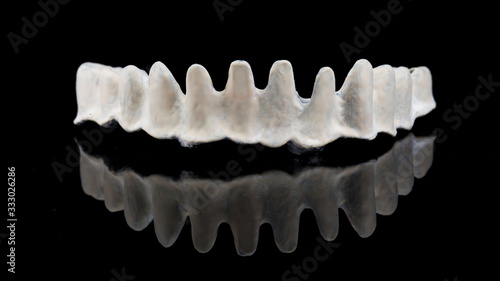 titanium beam with apak material on the lower jaw of the patient, shot on a black mirror with reflection photo