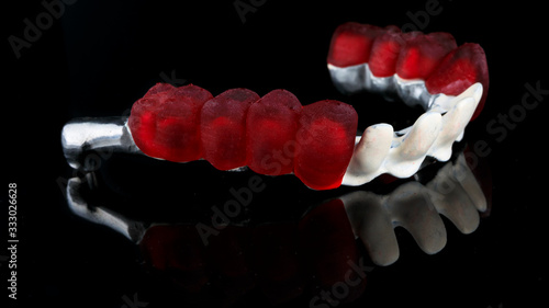 titanium dental beam in apak material, with red wax crowns on the chewing part photo