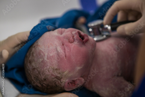 Close up image of a newly born, covered in vernix baby in a hospital photo