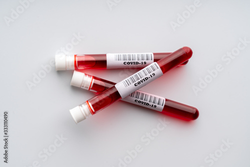 Blood test sample for COVID 19 virus